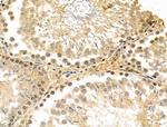 NUDT6 Antibody in Immunohistochemistry (Paraffin) (IHC (P))