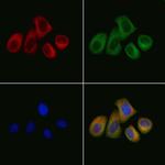 TBRG4 Polyclonal Antibody