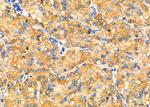 TBRG4 Antibody in Immunohistochemistry (Paraffin) (IHC (P))