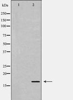 TGF alpha Polyclonal Antibody