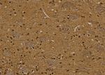 TCL1A Antibody in Immunohistochemistry (Paraffin) (IHC (P))