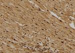 CDCA8 Antibody in Immunohistochemistry (Paraffin) (IHC (P))