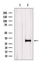 CDCA8 Antibody in Western Blot (WB)