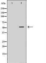 STEAP3 Polyclonal Antibody