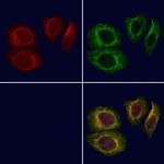 TCTN3 Polyclonal Antibody