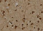 TCTN3 Antibody in Immunohistochemistry (Paraffin) (IHC (P))