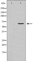 TCTN3 Antibody in Western Blot (WB)