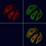 PRKAR1A Polyclonal Antibody