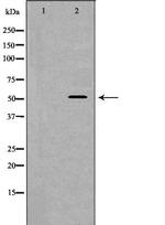 WASP Polyclonal Antibody