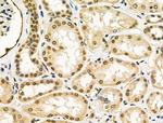 cIAP1 Antibody in Immunohistochemistry (Paraffin) (IHC (P))