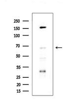 cIAP1 Antibody in Western Blot (WB)