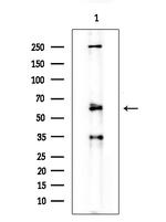 cIAP1 Antibody in Western Blot (WB)