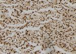 NCK1 Antibody in Immunohistochemistry (Paraffin) (IHC (P))