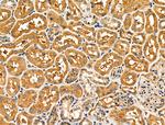 NCK1 Antibody in Immunohistochemistry (Paraffin) (IHC (P))