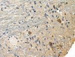NCK1 Antibody in Immunohistochemistry (Paraffin) (IHC (P))