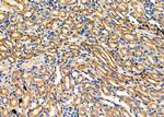TPMT Polyclonal Antibody