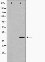 Carbonic Anhydrase I Polyclonal Antibody