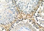 PSMB1 Antibody in Immunohistochemistry (Paraffin) (IHC (P))