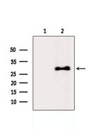 U2AF1 Polyclonal Antibody