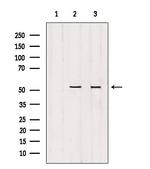 GSS Antibody in Western Blot (WB)