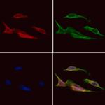 ARPC1A Polyclonal Antibody