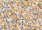 ARPC1A Antibody in Immunohistochemistry (Paraffin) (IHC (P))
