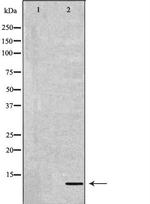 DEFB132 Polyclonal Antibody