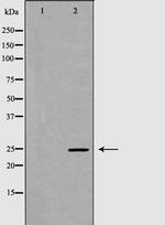 GPX5 Antibody in Western Blot (WB)