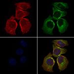 SLC27A2 Polyclonal Antibody