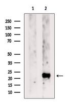 HIP2 Antibody in Western Blot (WB)