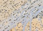 PP1 beta Polyclonal Antibody