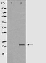 RNase11 Polyclonal Antibody