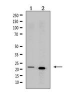 CRF Polyclonal Antibody