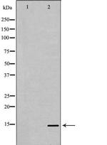PHPT1 Polyclonal Antibody