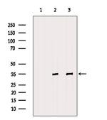 Fibrillarin Polyclonal Antibody