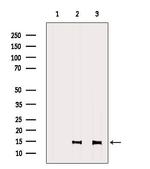 SH2D1A Polyclonal Antibody