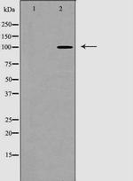 alpha Actinin 1 Polyclonal Antibody
