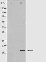 Calmodulin 1/2/3 Polyclonal Antibody