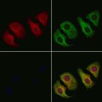 SMPD2 Polyclonal Antibody