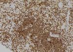 CDC25A Polyclonal Antibody