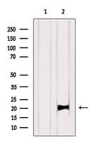 K-Ras Polyclonal Antibody