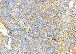 Cystatin 8 Polyclonal Antibody