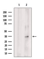 GIPC2 Polyclonal Antibody