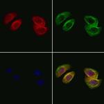 PLA2G2A Polyclonal Antibody