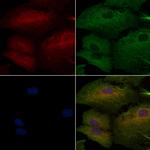 HLA-DR/DP Polyclonal Antibody
