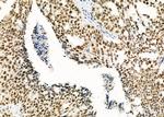 RBBP4 Polyclonal Antibody