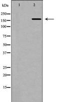 Collagen V Polyclonal Antibody