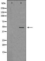 PSMC5 Polyclonal Antibody