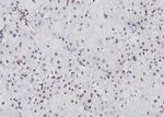 NFATC1 Antibody in Immunohistochemistry (Paraffin) (IHC (P))