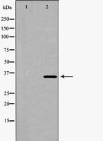 CDK6 Polyclonal Antibody